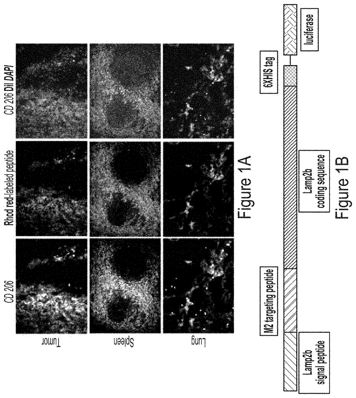 Engineered Exosomes to Detect and Deplete Pro-Tumorigenic Macrophages