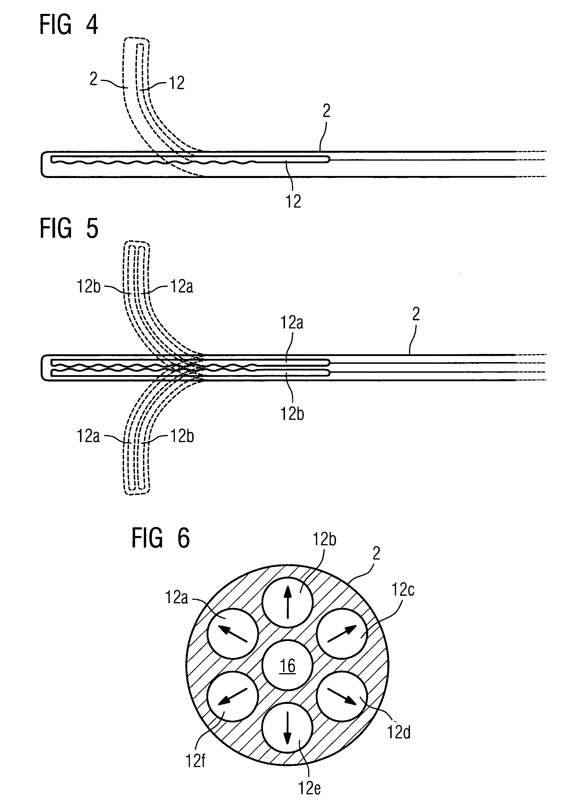 Catheter