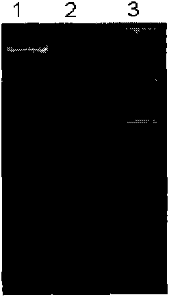 Human FGF21 mutant gene and method for preparing recombinant human FGF21 protein