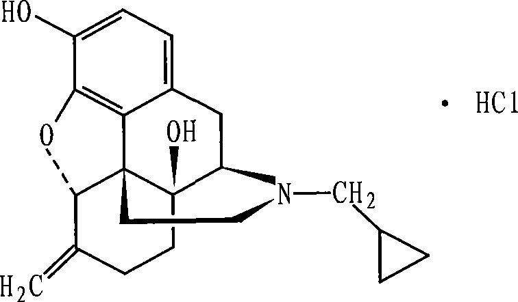 Nalmefene hydrochloride injection and preparation method thereof