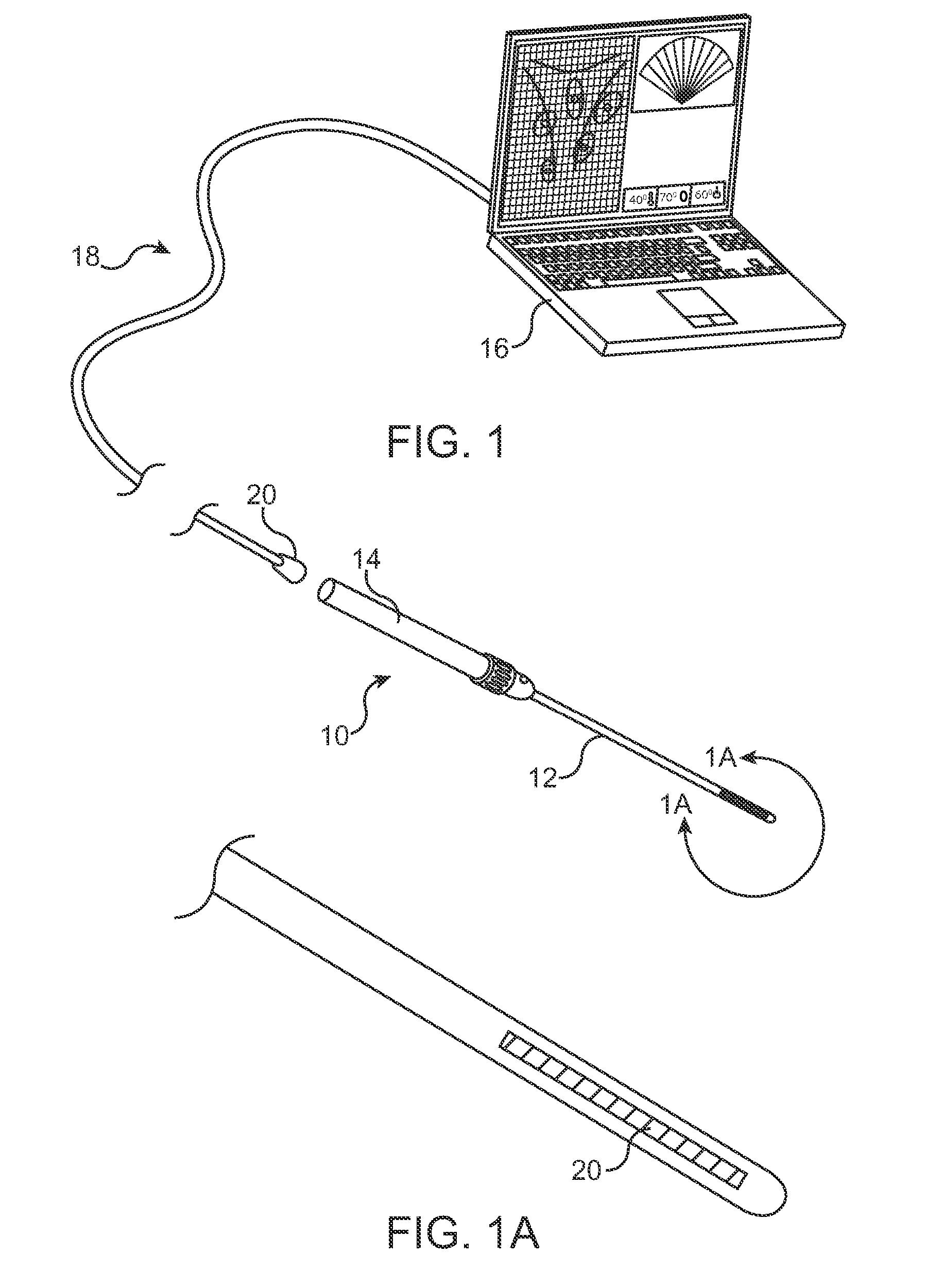 Intrauterine ultrasound and method for use