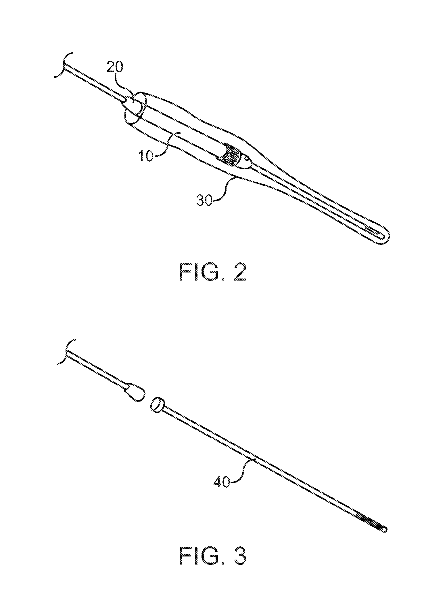 Intrauterine ultrasound and method for use