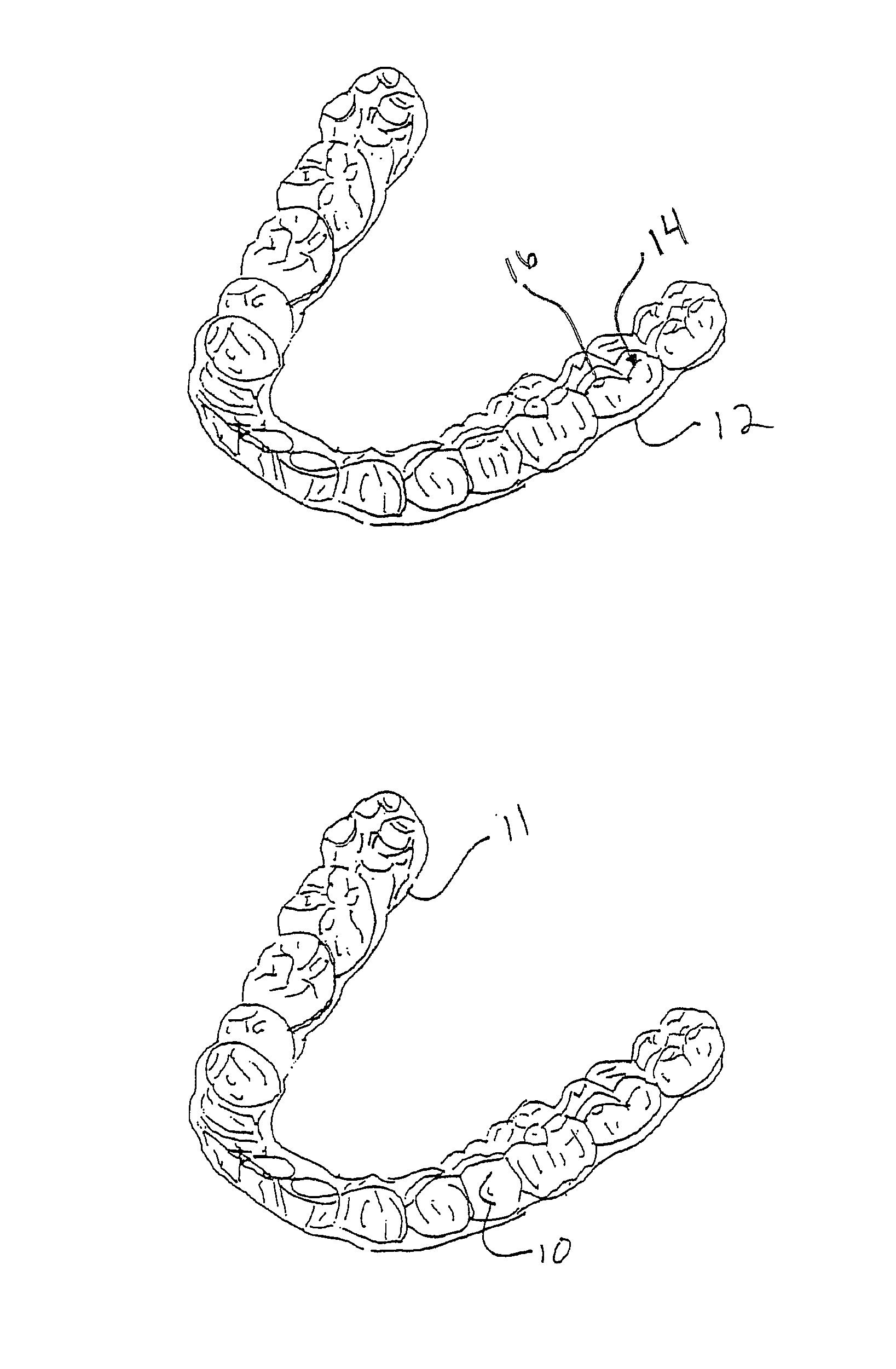 Method and system for personalized orthodontic treatment