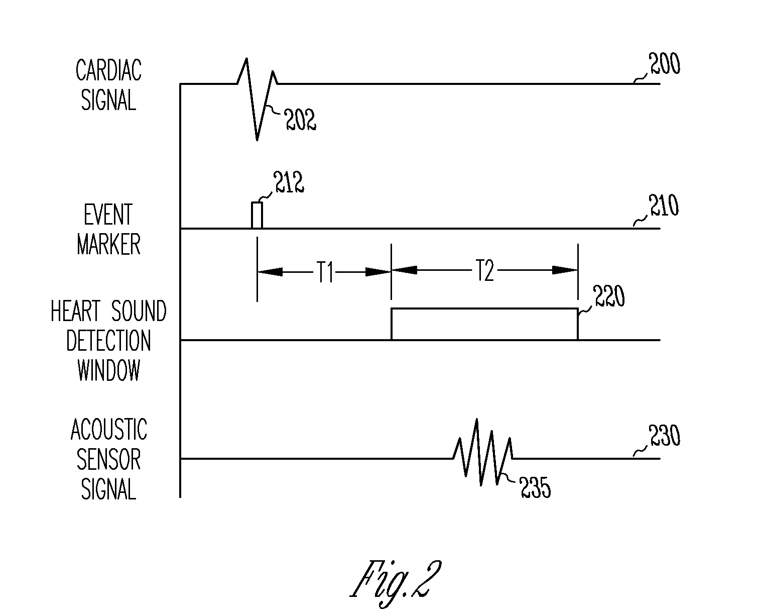 Method and apparatus for monitoring of diastolic hemodynamics