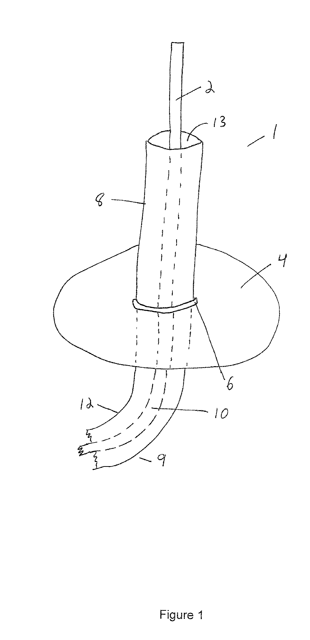 Dual Band Sleeve Antenna