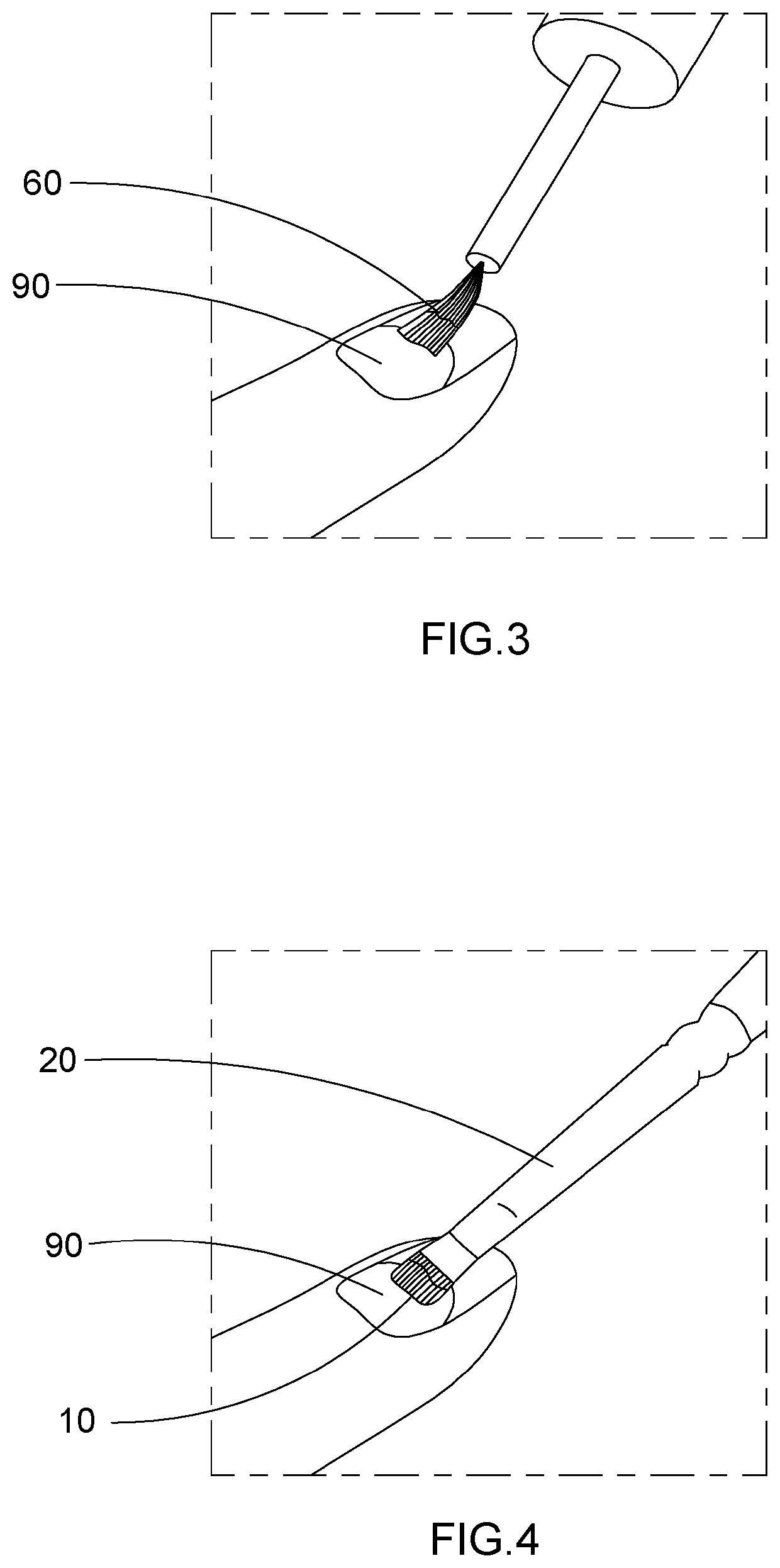 Artificial nail tip and curing composition set and applying method thereof