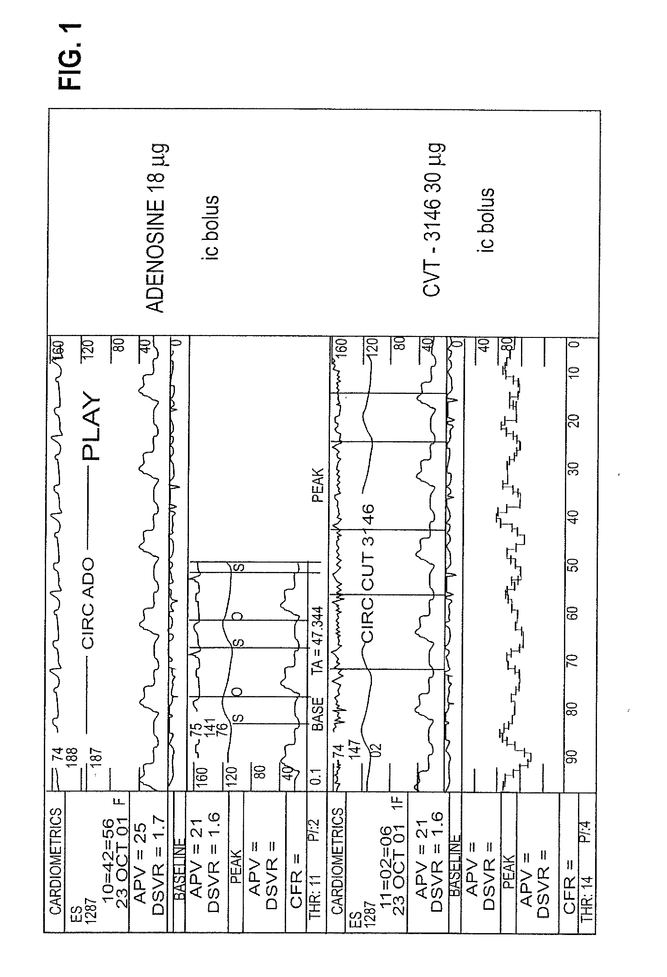 Myocardial perfusion imaging method