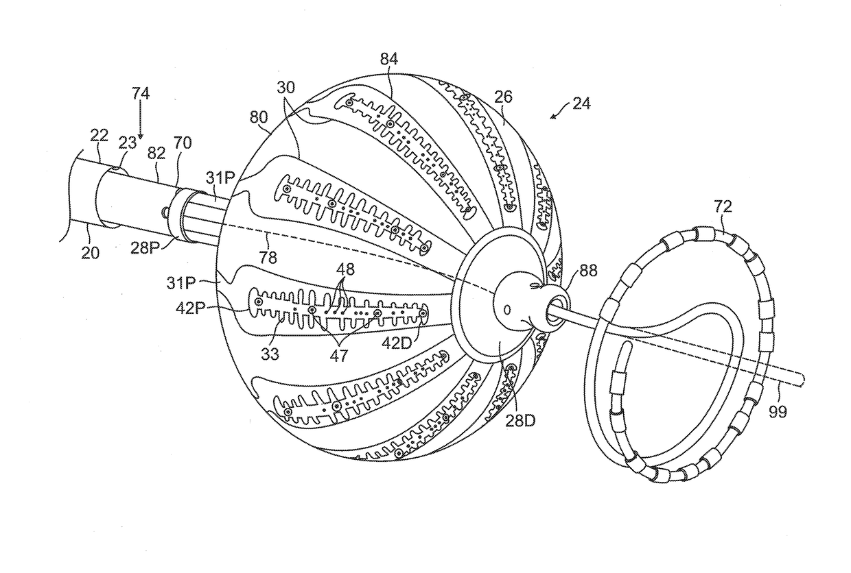 Irrigated balloon catheter with flexible circuit electrode assembly