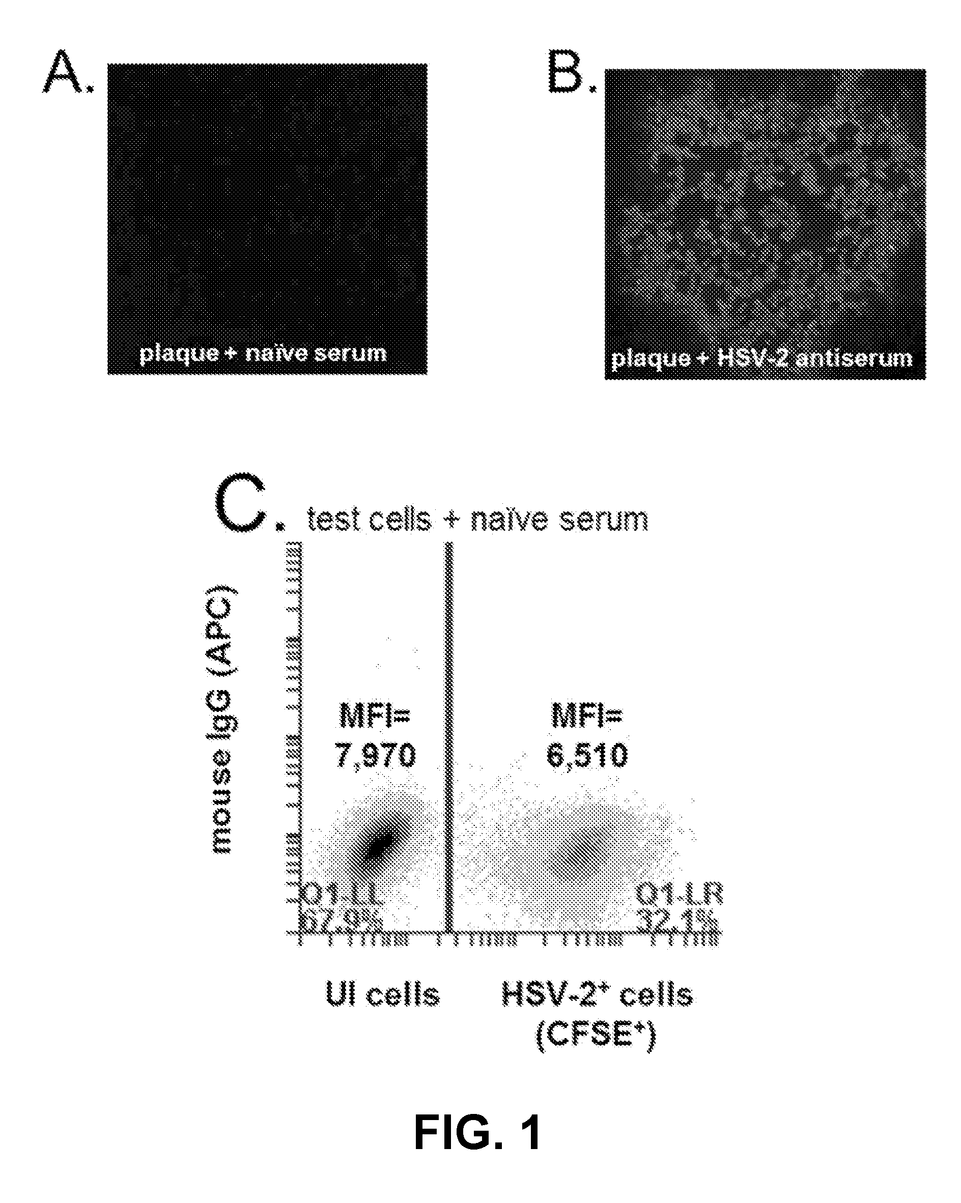 Rapid and sensitive serological assay to determine if patients are infected with herpes simplex virus type 1 hsv-1 and/or type 2 hsv-2