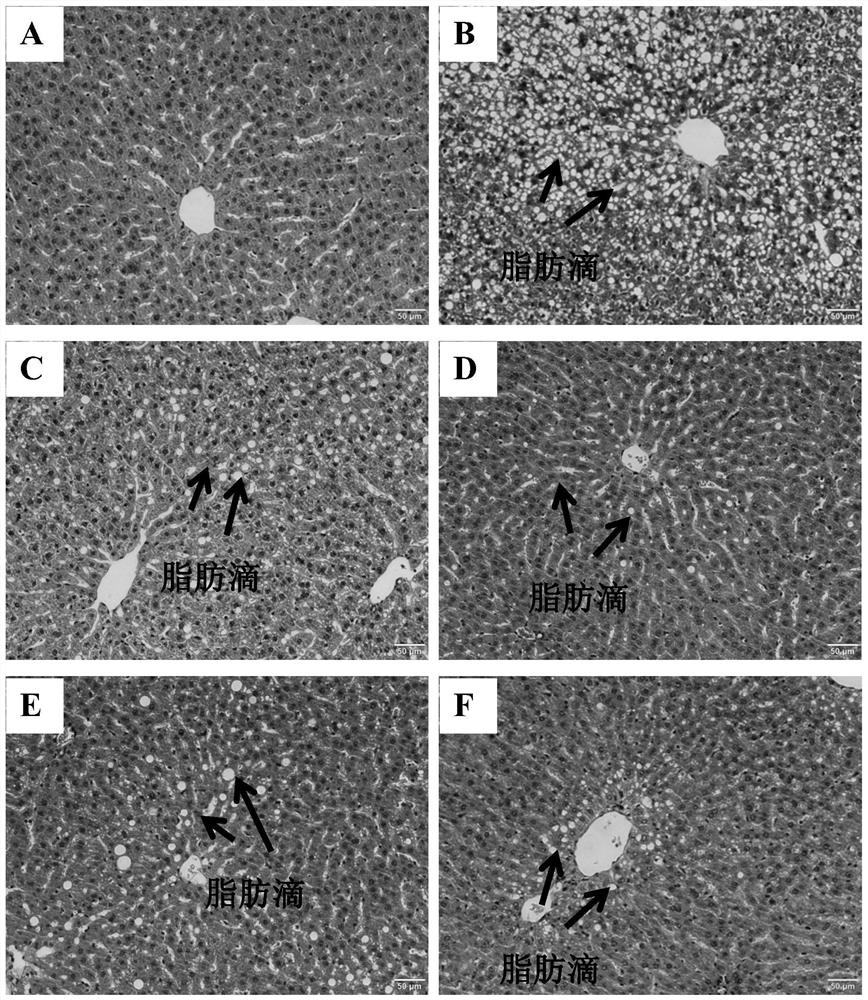 Application of Rhus chinensis Mill. fruit in preparation of medicine for treating or preventing non-alcoholic fatty liver disease