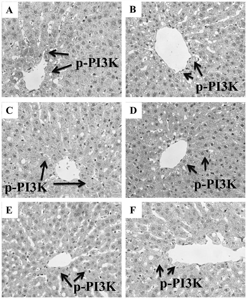 Application of Rhus chinensis Mill. fruit in preparation of medicine for treating or preventing non-alcoholic fatty liver disease