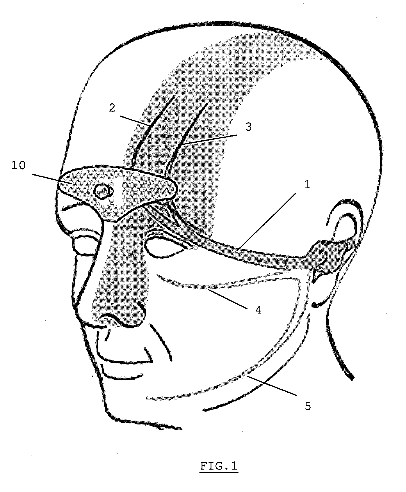 Device for the electrotherapeutic treatment of tension headaches