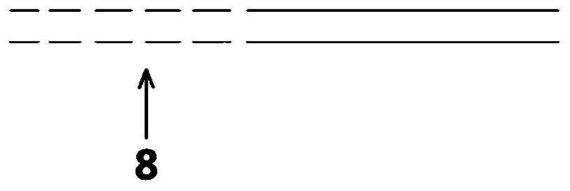 Single pigtail transplanted kidney support drainage catheter for kidney transplantation from child donors