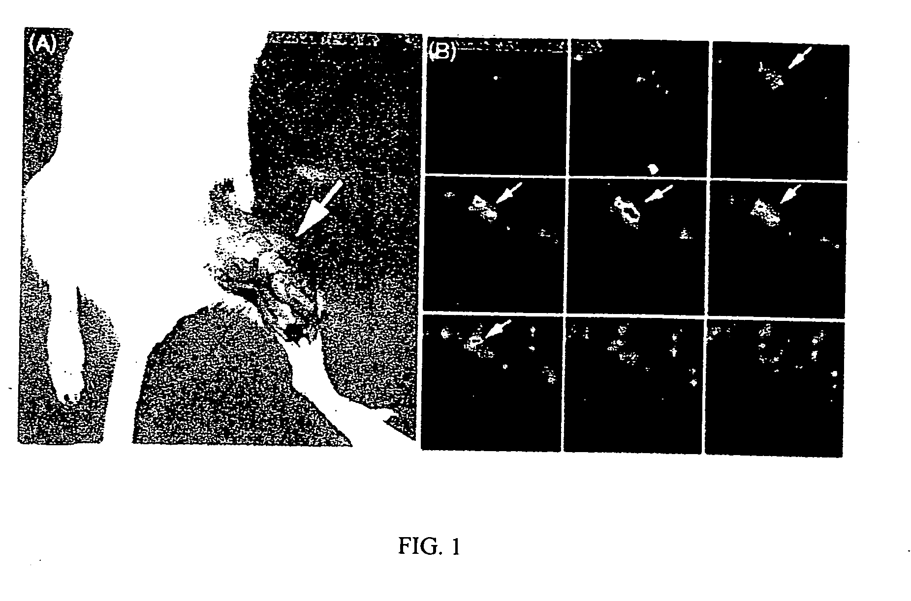 Technetium-99M glucarate methods of use for monitoring tissues