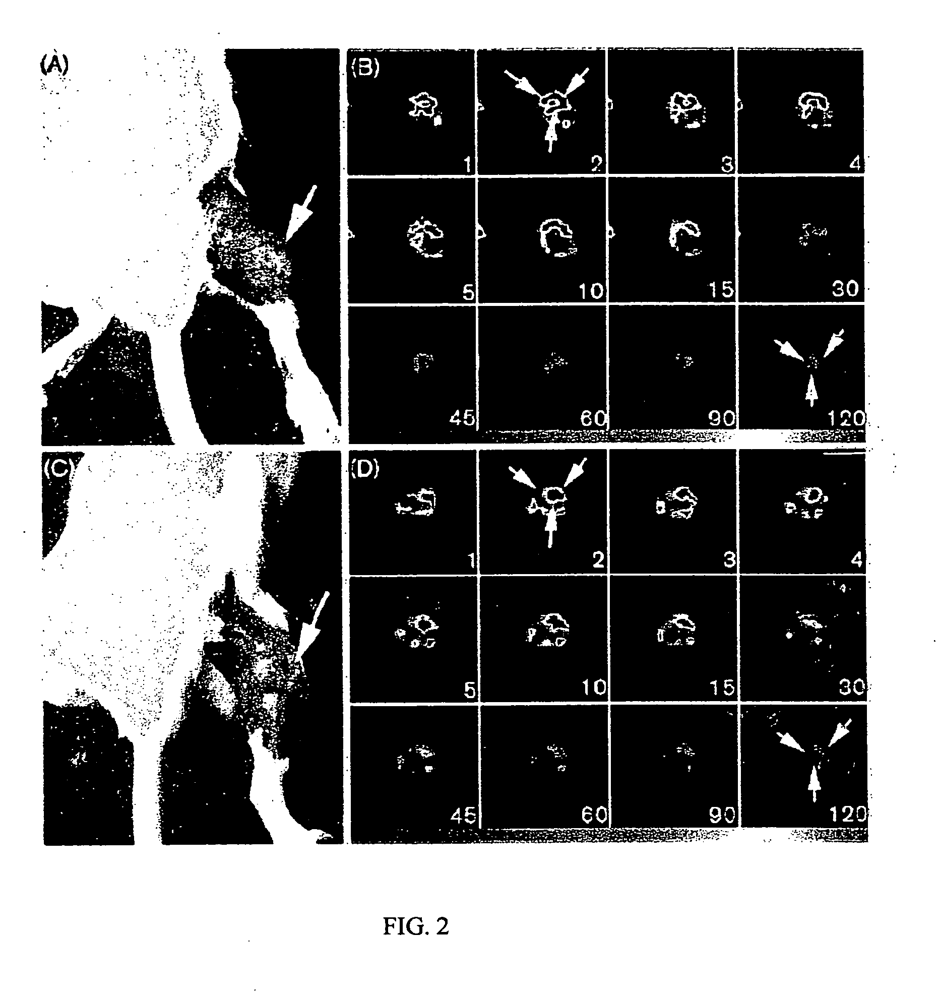 Technetium-99M glucarate methods of use for monitoring tissues