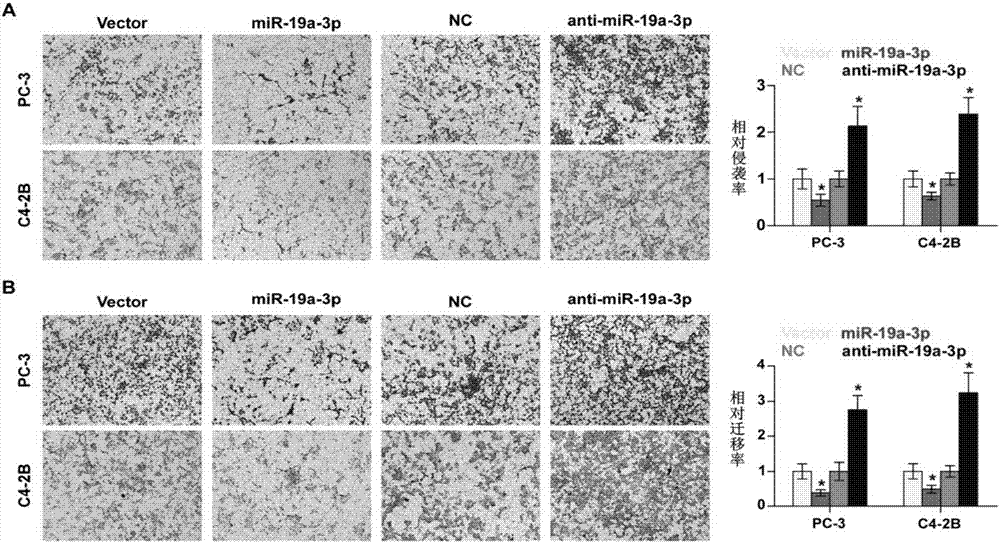 Application of miR-19a-3p in preparing diagnostic reagent and therapeutic drug for prostate cancer with osseous metastasis