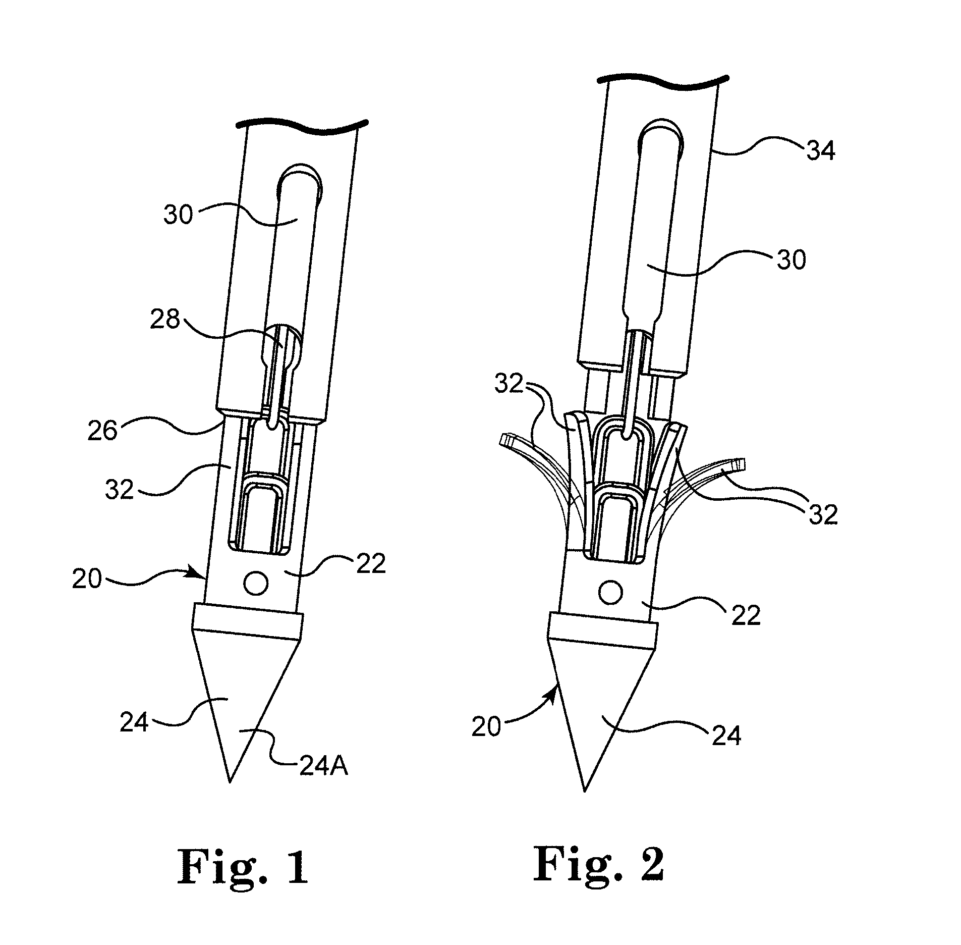 Bone anchor comprising a shape memory element and utilizing temperature transition to secure the bone anchor in bone