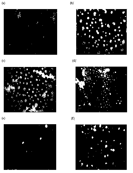 Synthesis method and application of chitosan oligosaccharide/indometacin graft