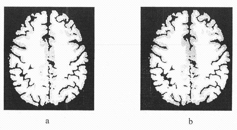 Related prediction model-based method for detecting structural deformation in magnetic resonance image