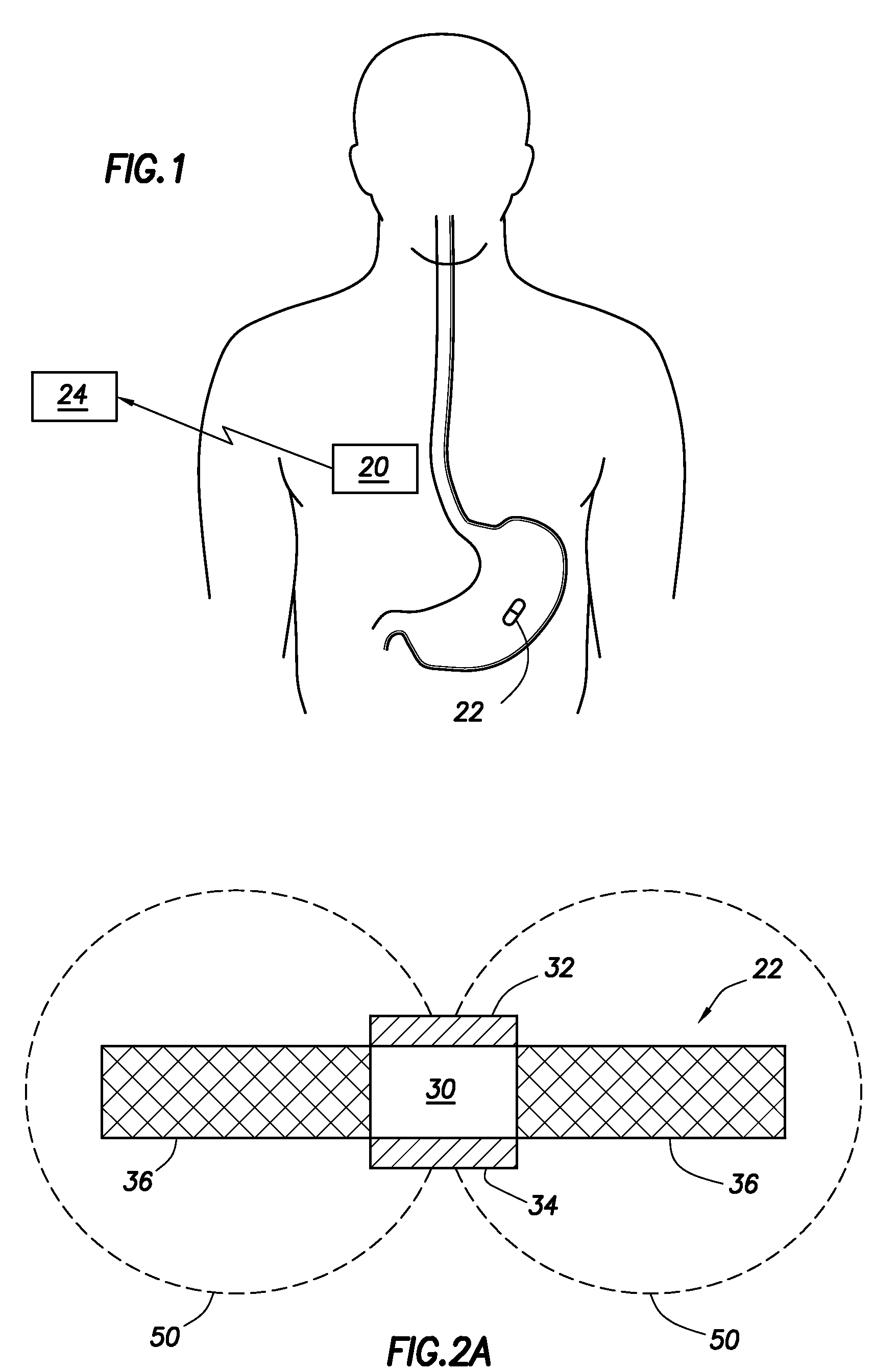 Evaluation of gastrointestinal function using portable electroviscerography systems and methods of using the same