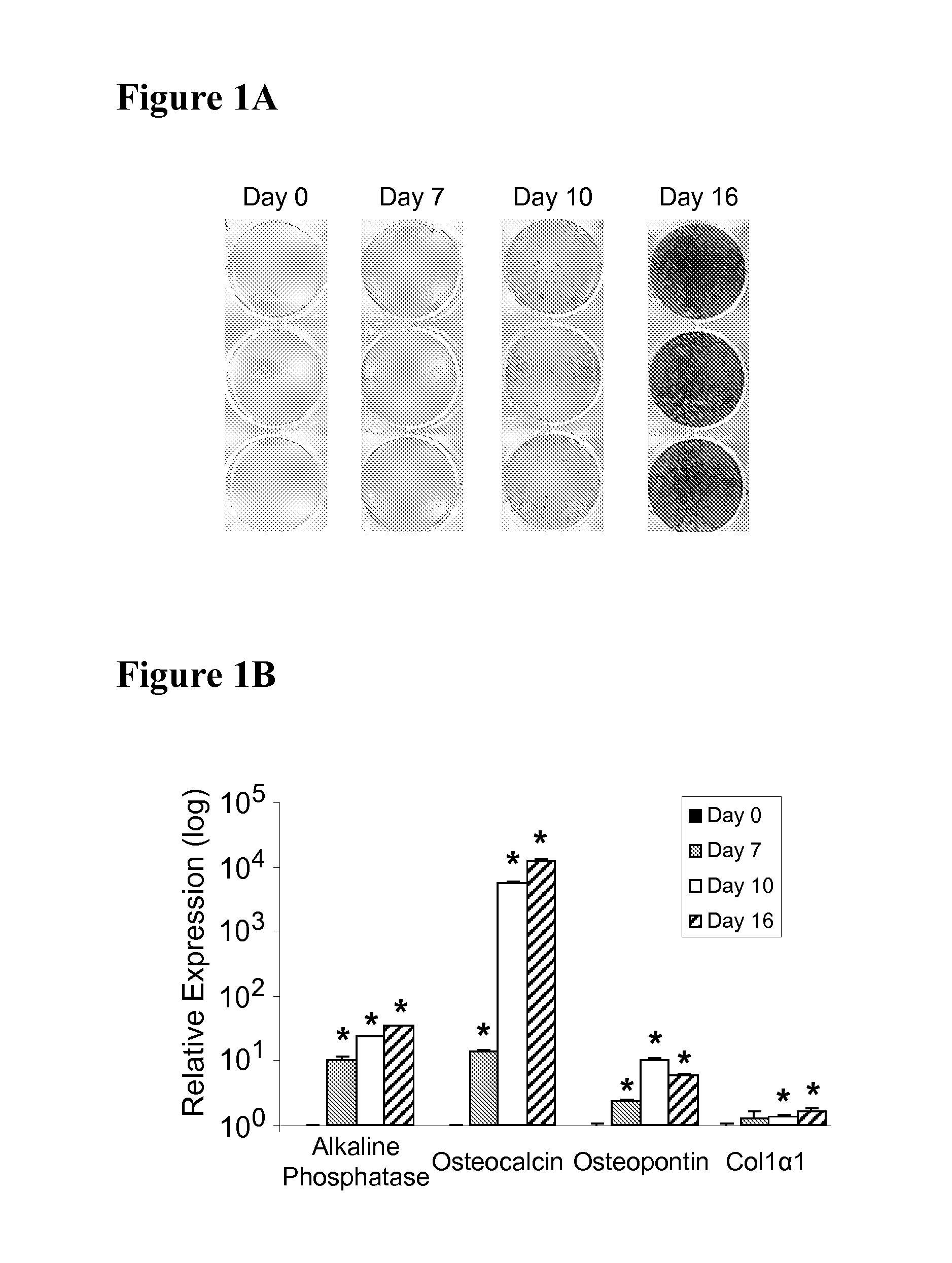 Methods and materials for reducing bone loss