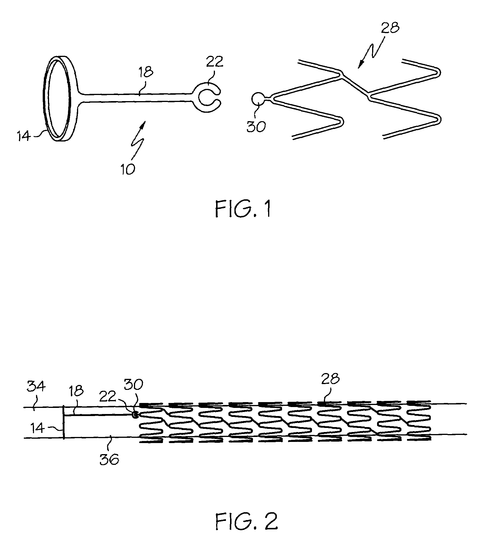 Mechanism to improve stent securement