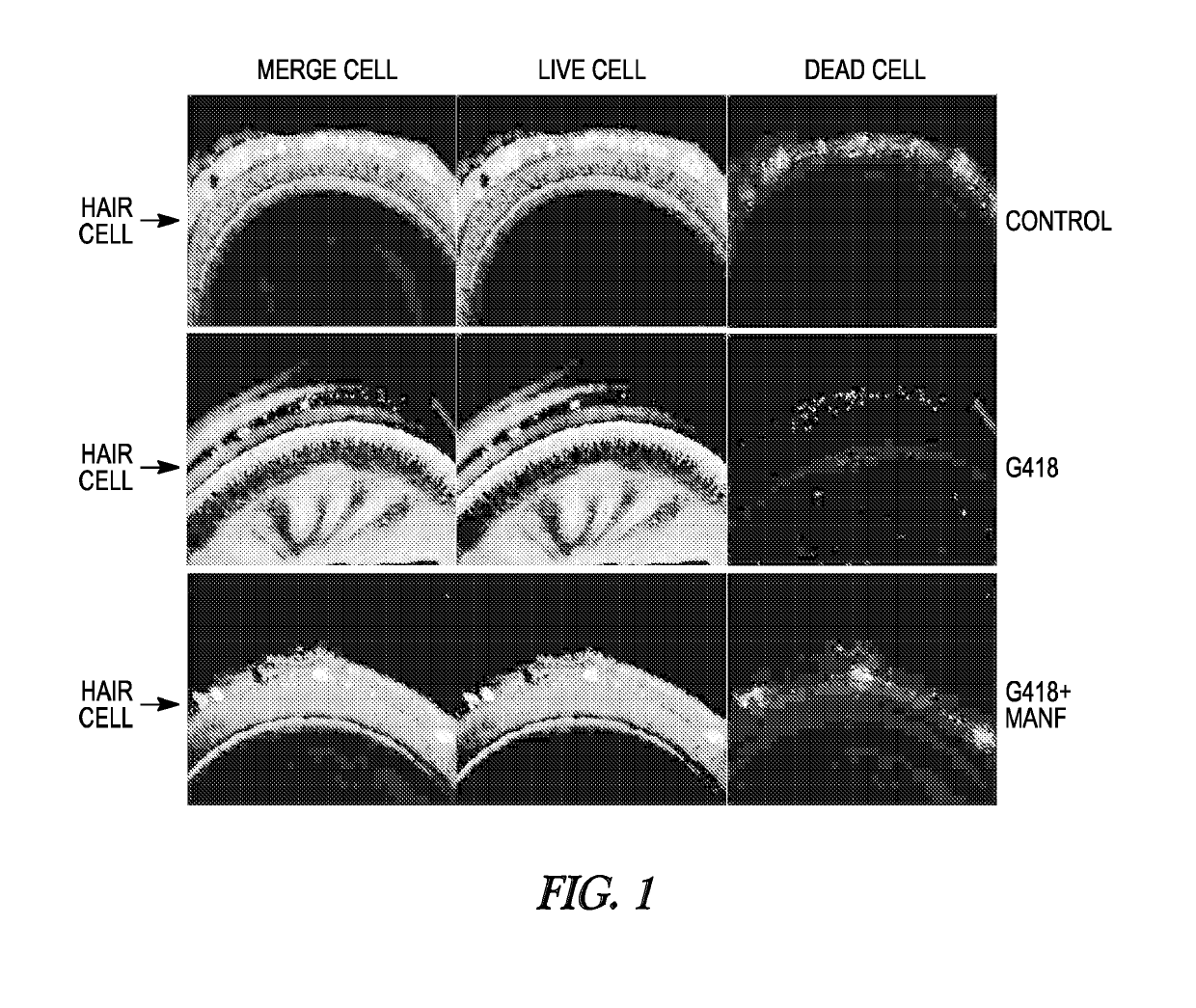 Method of administering MANF for the protection of sensory cells