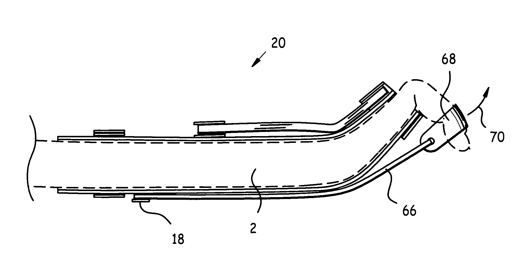 Exercise glove for intrinsic muscles and method of use