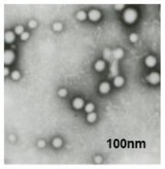 Preparation method of exosome and stem cell proliferation reagent containing exosome