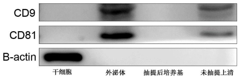 Preparation method of exosome and stem cell proliferation reagent containing exosome