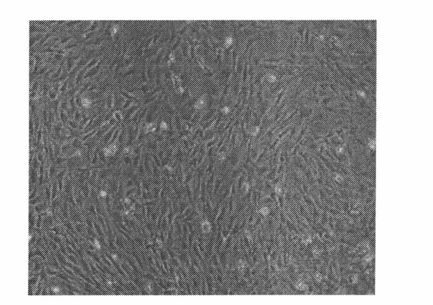 Kit and method for fast separating bone marrow mesenchymal stem cells