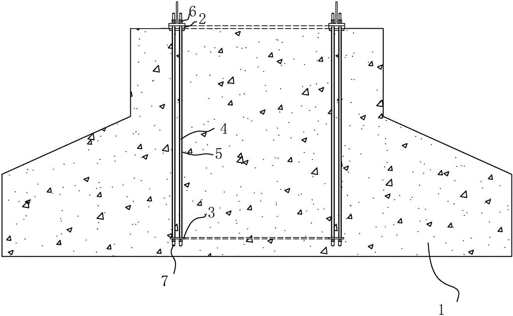 Anchor cage ring type foundation with replaceable anchor bolt