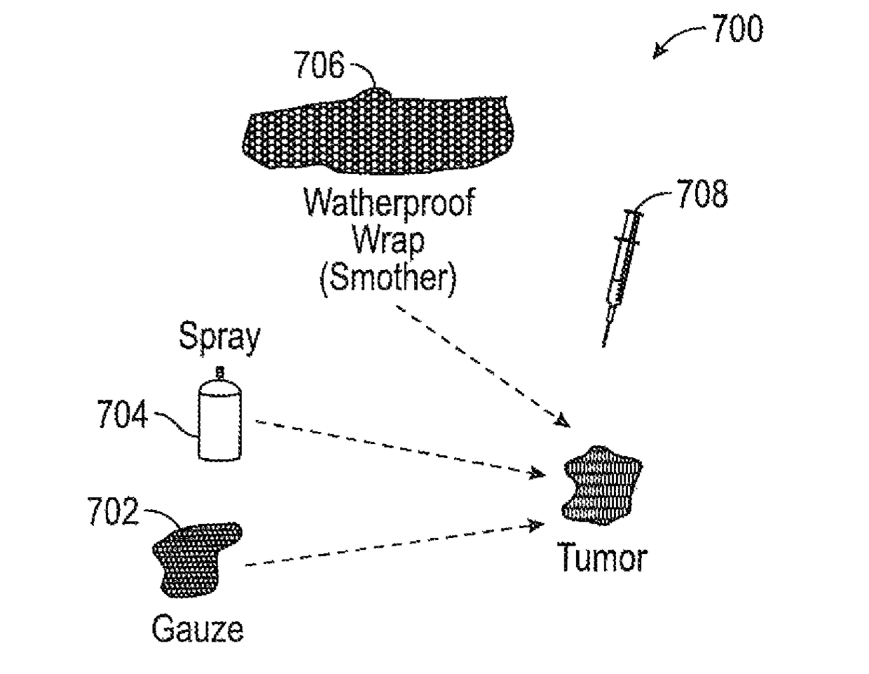 Rapid destruction of malignant tumors by excitotoxicity and osmotic-shock medical tactics