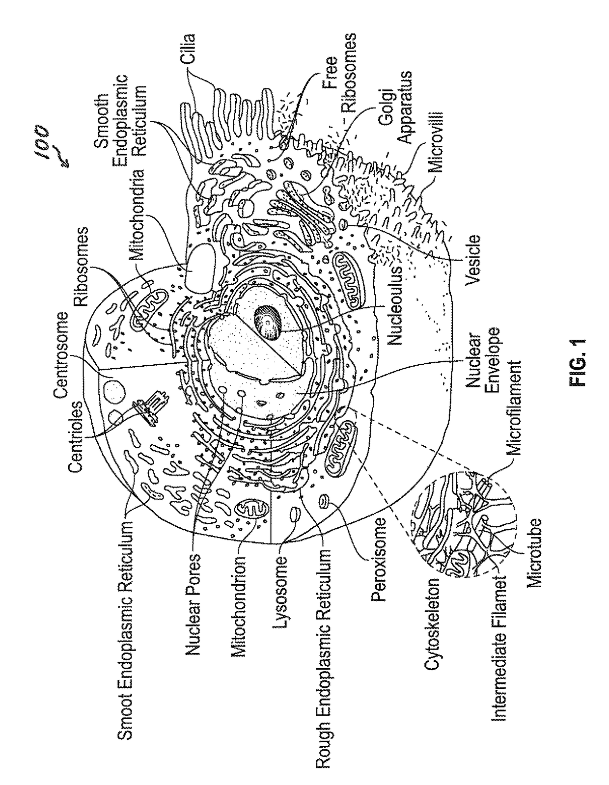 Rapid destruction of malignant tumors by excitotoxicity and osmotic-shock medical tactics