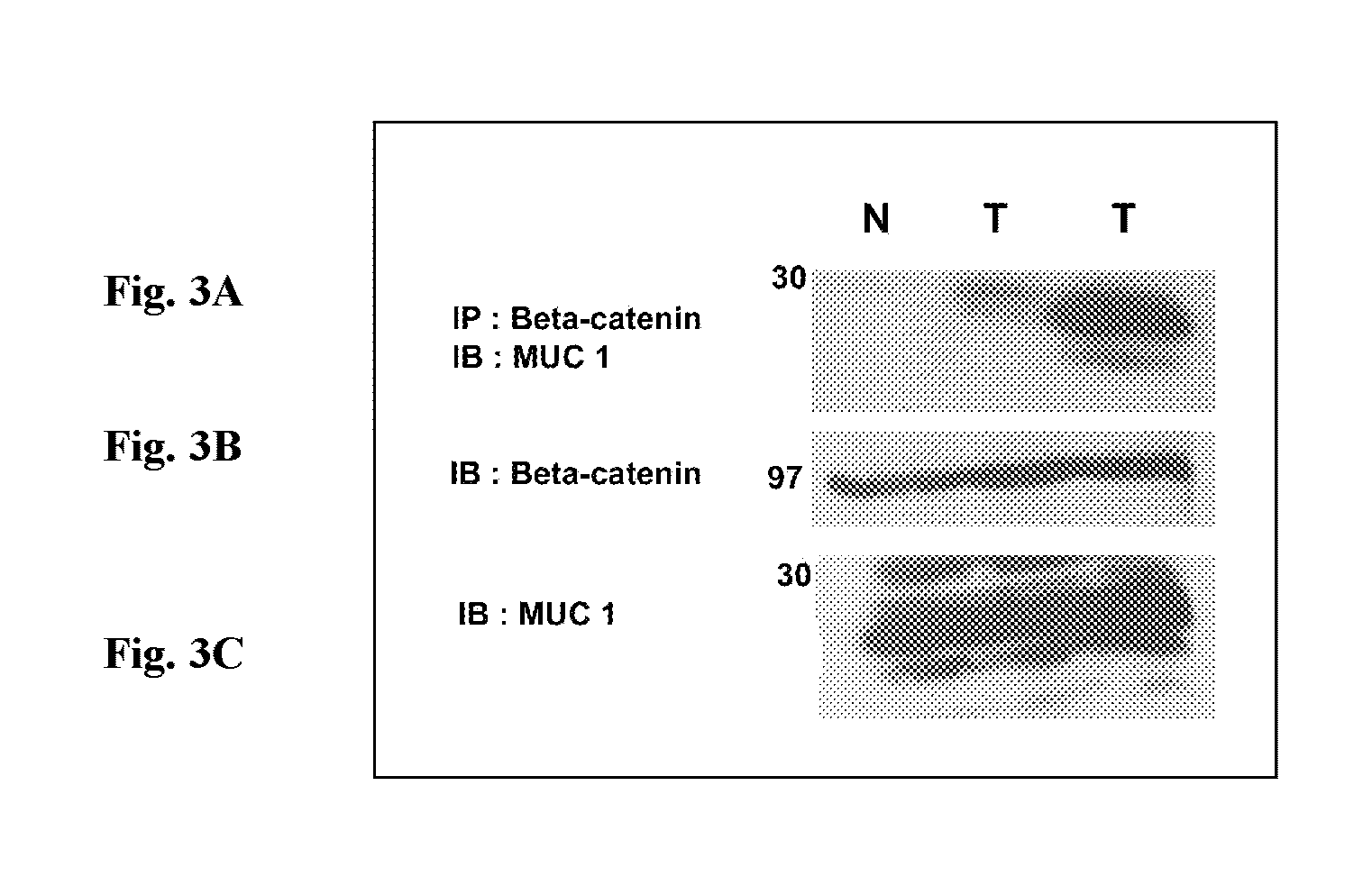 Therapeutic peptides for the treatment of metatstatic cancer