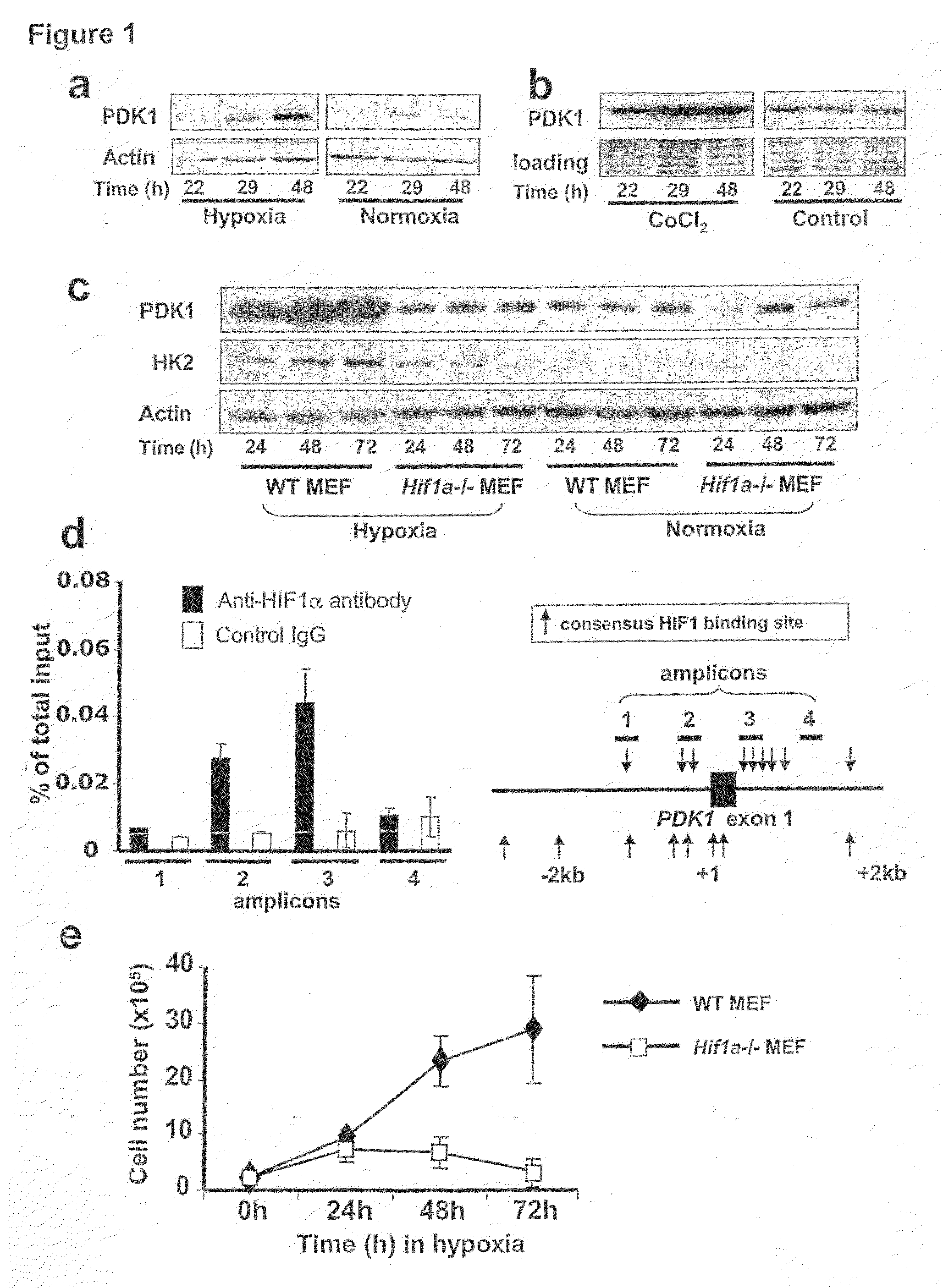 Pyruvate dehydrogenase kinases as therapeutic targets for cancer and ischemic diseases