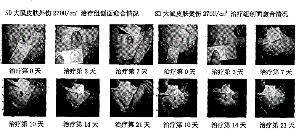 Preparation of fibroblast growth factor-1 modified gel and its application in the treatment of diabetic foot