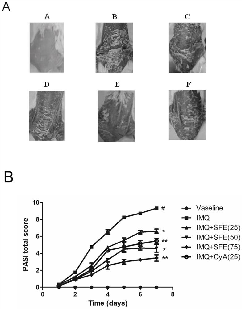 Medicine for treating psoriasis