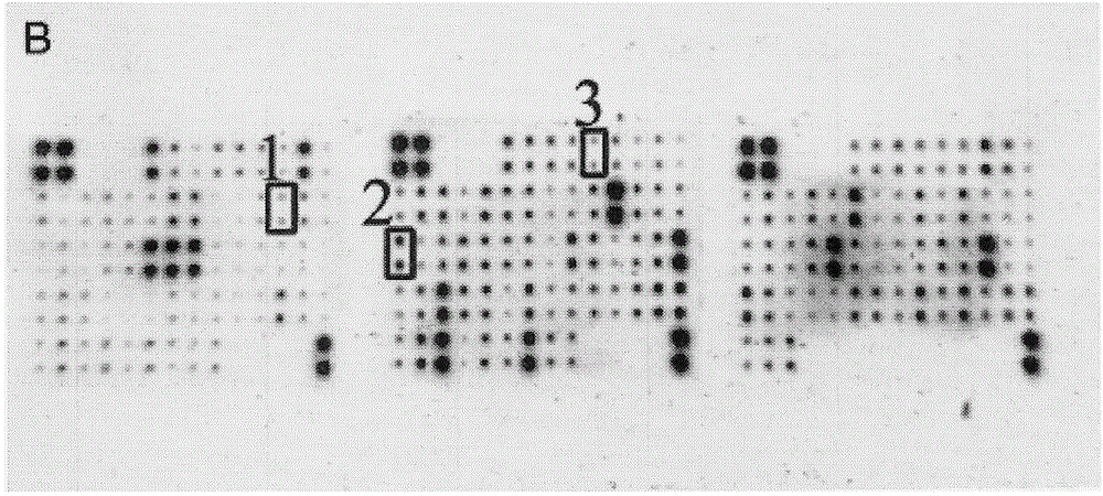 A kit for detecting premature rupture of membranes