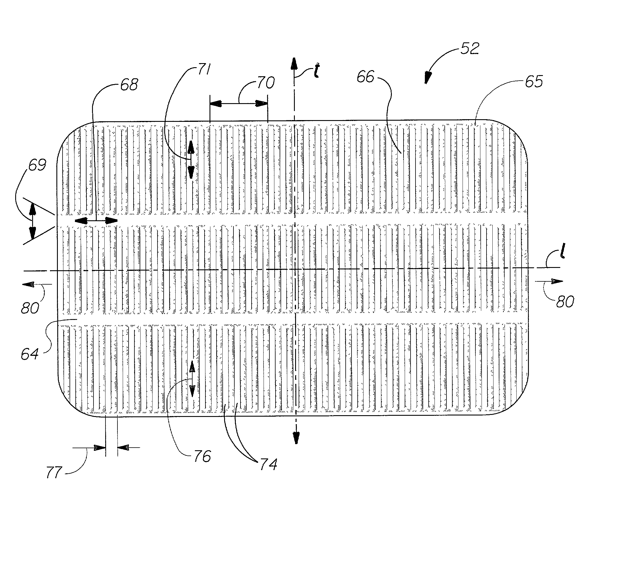 Absorbent article with multiple zone structural elastic-like film web extensible waist feature