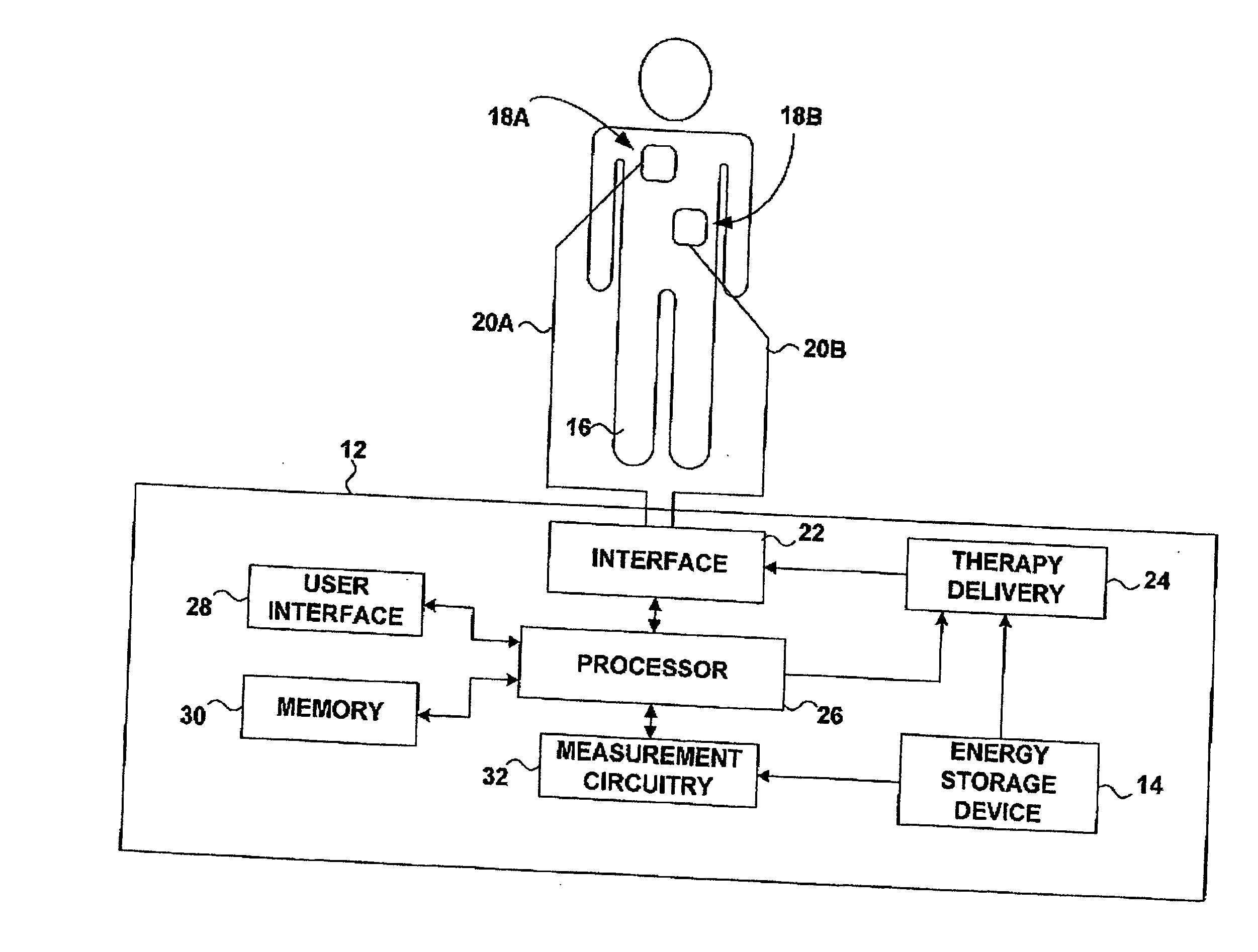 External defibrillator with charge advisory algorithm