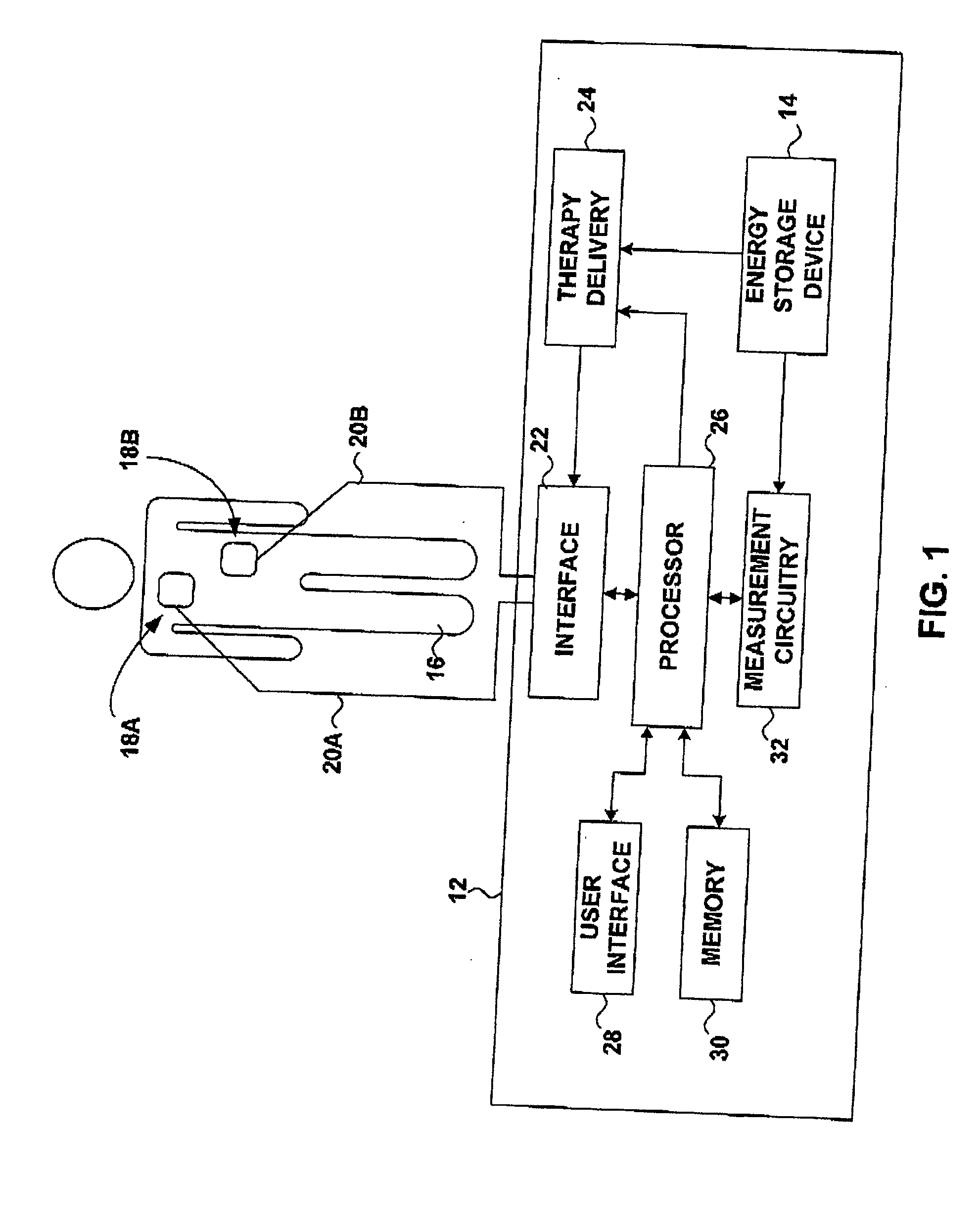 External defibrillator with charge advisory algorithm