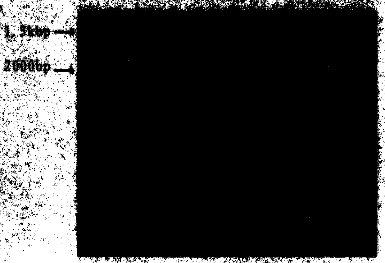 Salmonella CRISPR (clustered regularlay interspaced short palindromic repeats) sequencing typing method