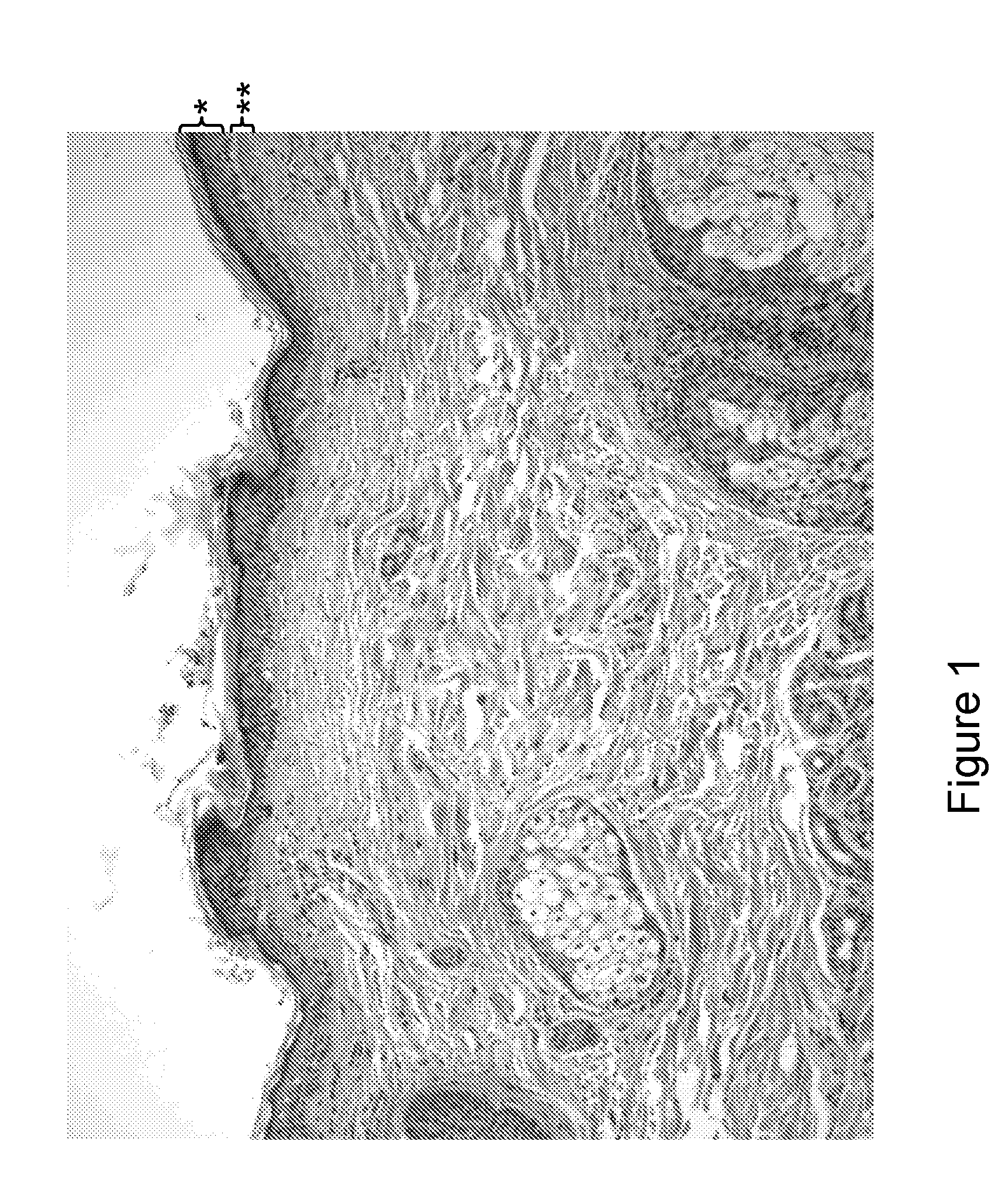 Method and device for treating skin by superficial coagulation