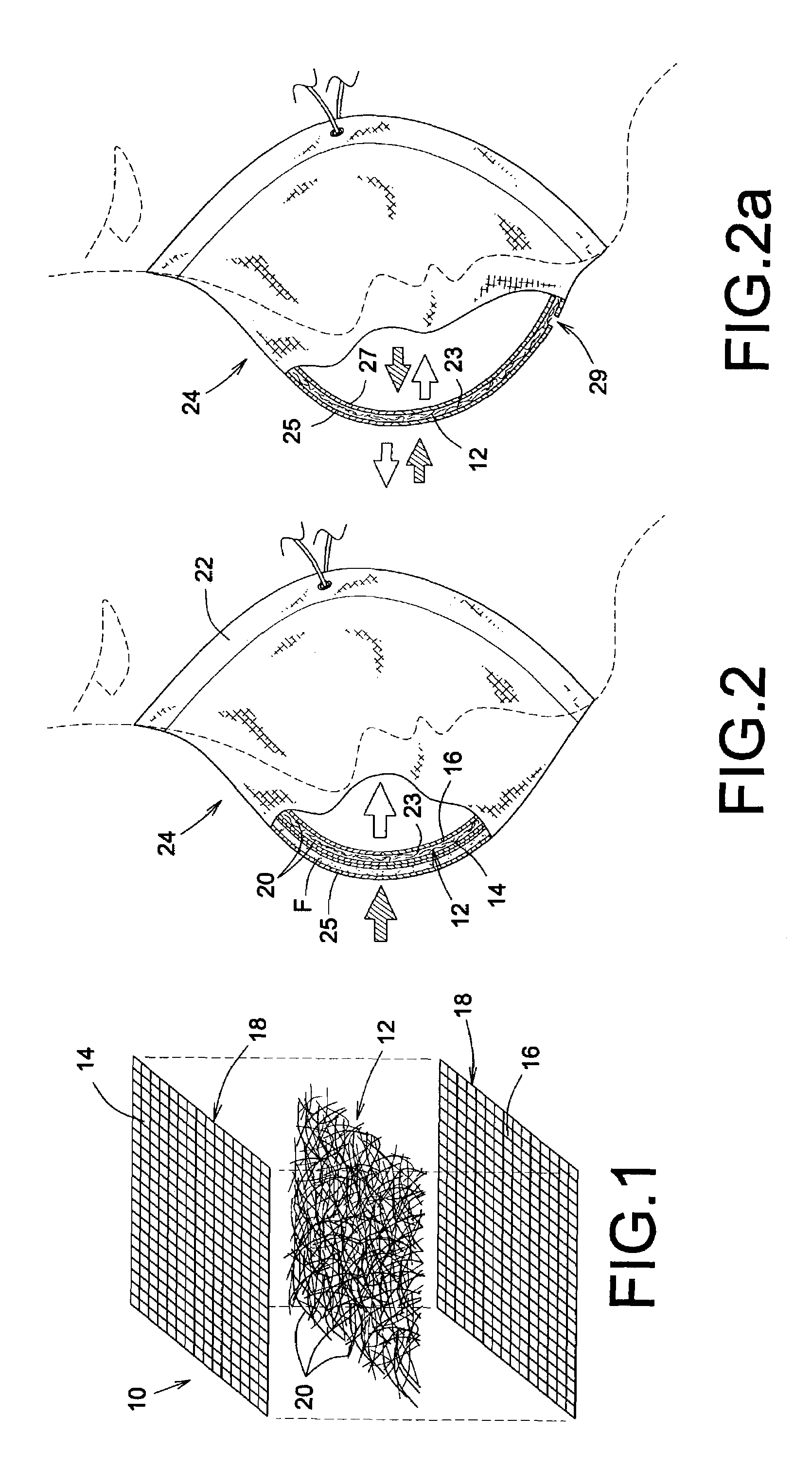 Microbicidal air filter