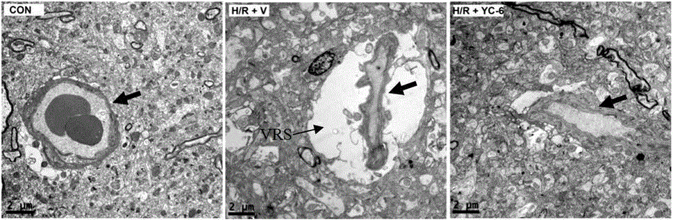 Application of 5alpha-androstane-3beta,5,6beta-triol and analogues thereof in prevention and treatment of altitude disease caused by hypobaric hypoxia