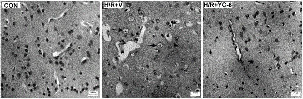 Application of 5alpha-androstane-3beta,5,6beta-triol and analogues thereof in prevention and treatment of altitude disease caused by hypobaric hypoxia