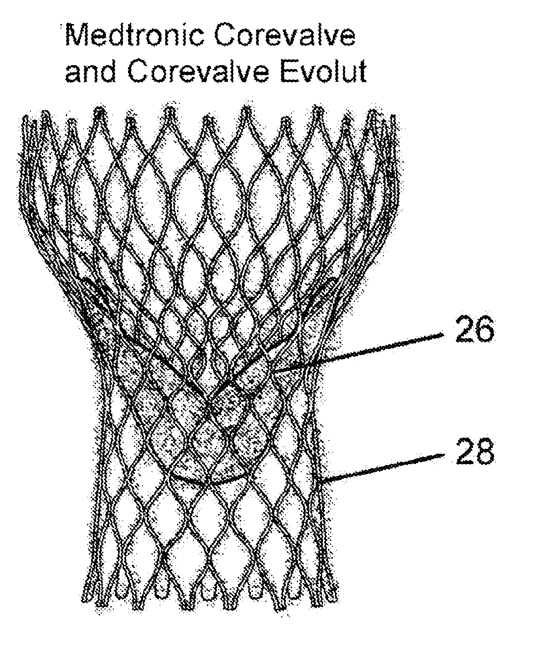 Methods for inhibiting stenosis, obstruction, or calcification of a stented heart valve or bioprosthesis