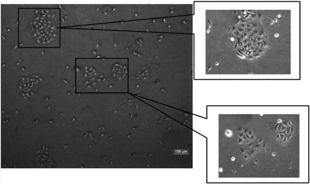 Isolated culture method of alveolar type II epithelial cells of naked mole rats