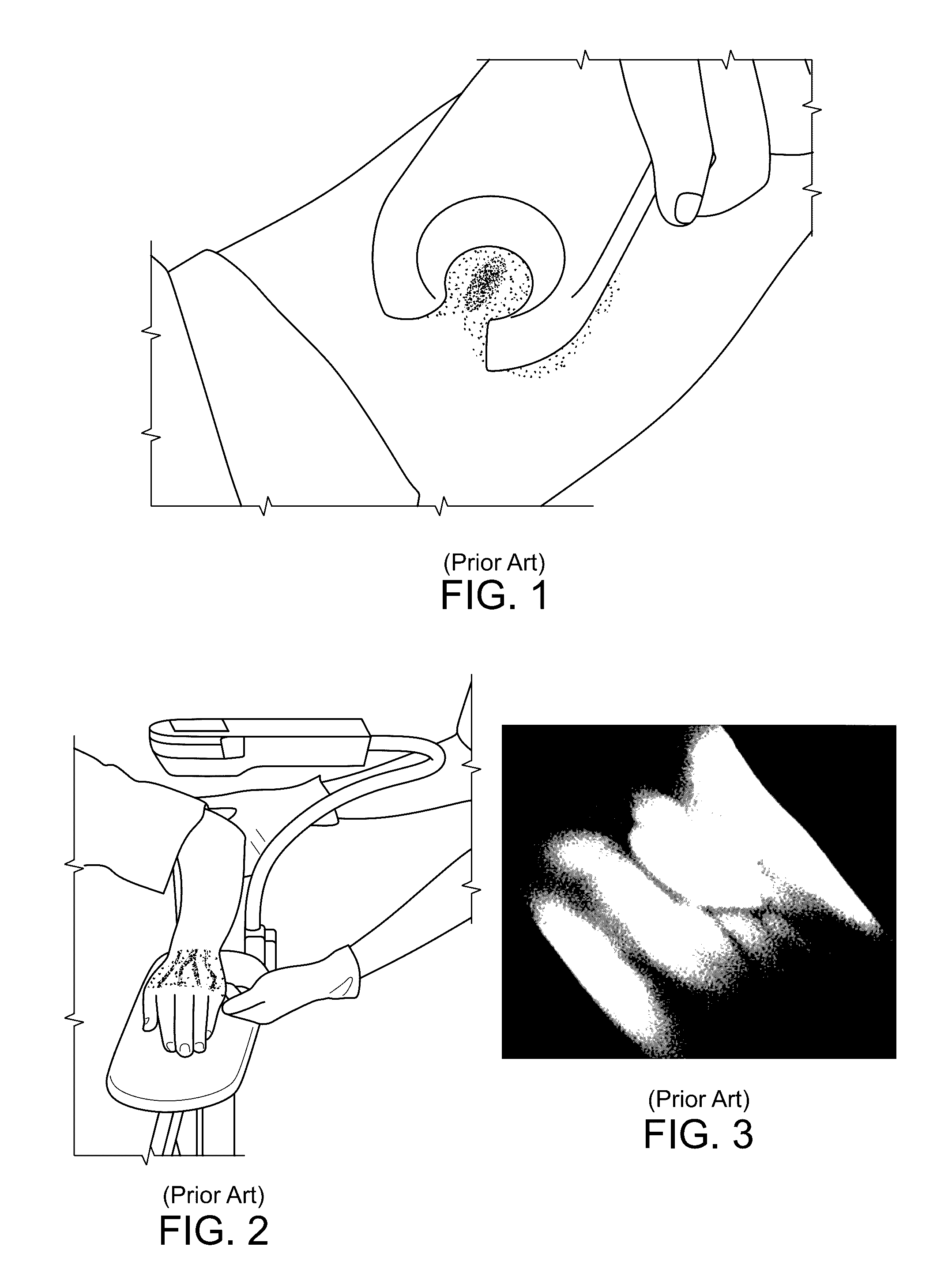 Medical illumination device